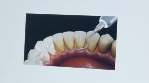 Щетка и паста не решат проблему. Врач докажет