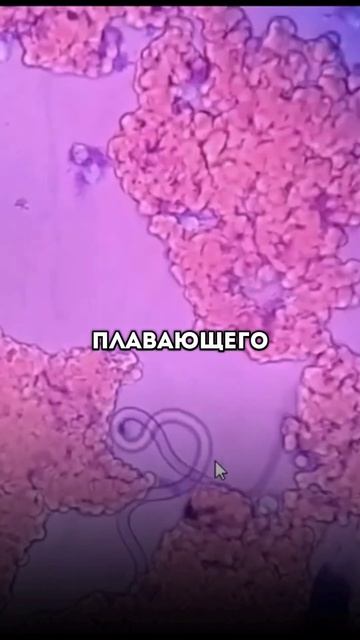 Паразитический червь в ваших глазах? #шортс #история смотреть онлайн