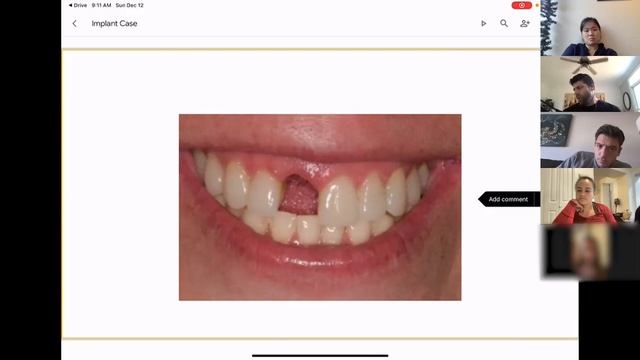 Oral Surgery Fight Club – Season 1 Episode 7 - Implants смотреть онлайн