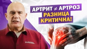 Артрит и артроз – в чём разница и как избежать ошибки в диагнозе?