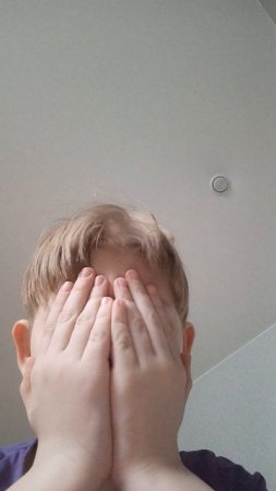Я разбил себе голову