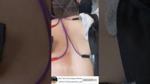 Электрофорез вотановления
