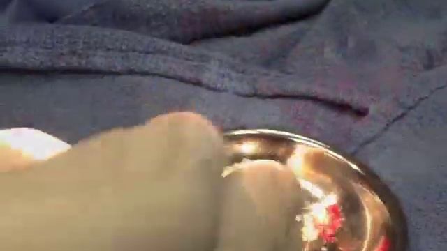 Dental implant and sinus lift bone grafting смотреть онлайн