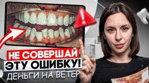 СНЯЛ БРЕКЕТЫ И СЛУЧИЛОСЬ ЭТО! Что НУЖНО делать после снятия брекетов или элайнеров?