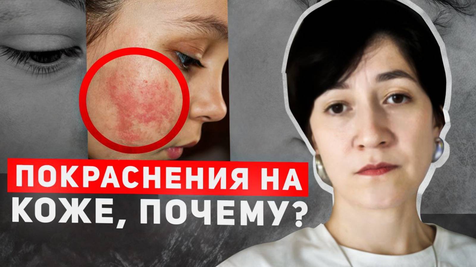 Покраснения на коже. Почему?