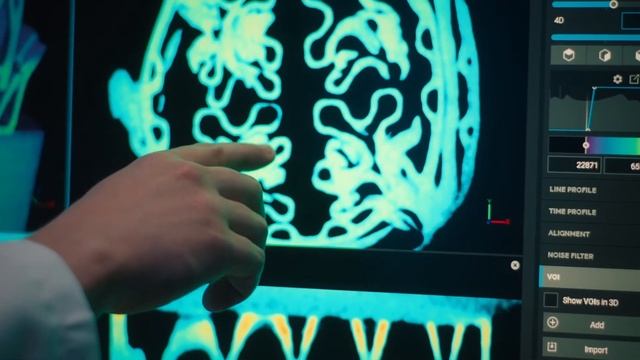 TESCAN micro-CT - KU Leuven Testimonial