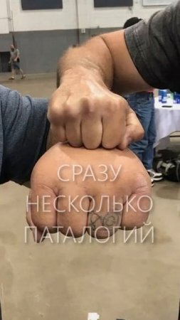 Самые большие руки в мире