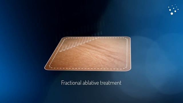 DERMABLATE ASCLEPION смотреть онлайн