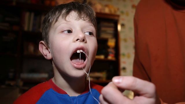 як вирвати зуб смотреть онлайн