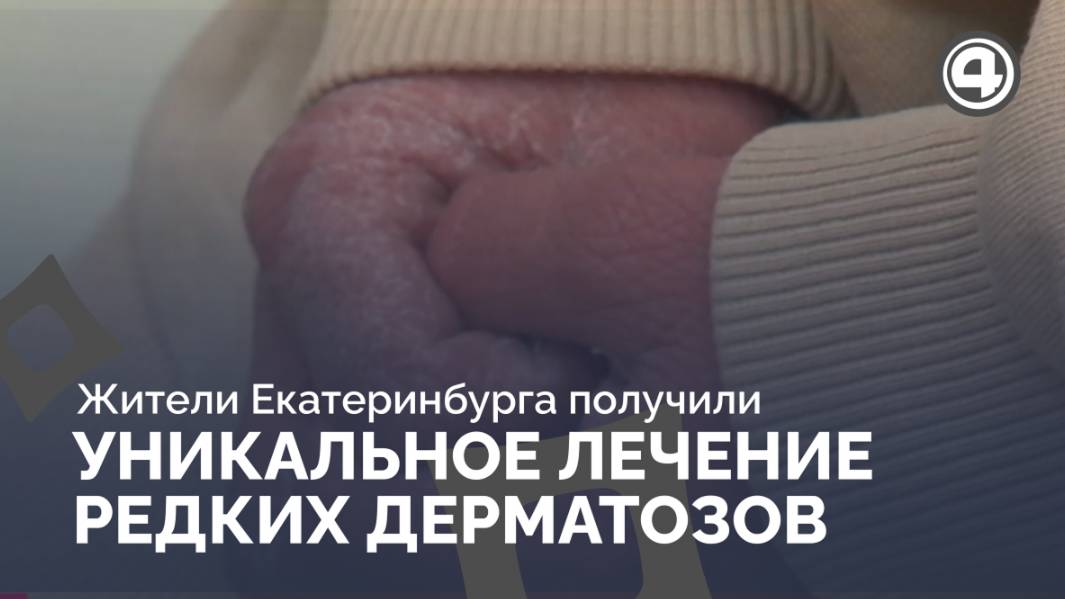 Цифровая дерматоскопия и фототерапия: прорыв в Центре генных дерматозов