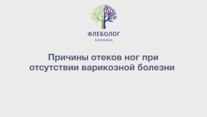 Если нет варикоза, но отекают ноги в конце дня, в чем может быть причина?