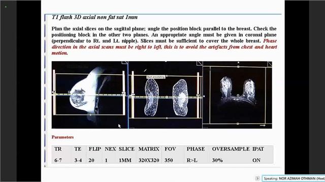 MRI BREAST ABDOMEN PELVIC - PN AZIMAH