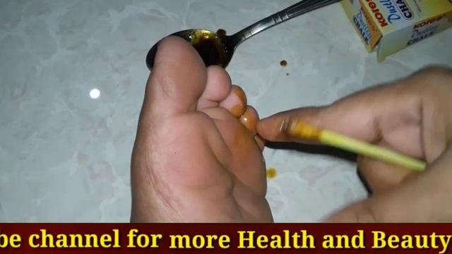 पैरों की उंगलीयों में सड़न का सटीक घरेलू उपाय Pairo ki ungliyo me fungal infection смотреть онлайн