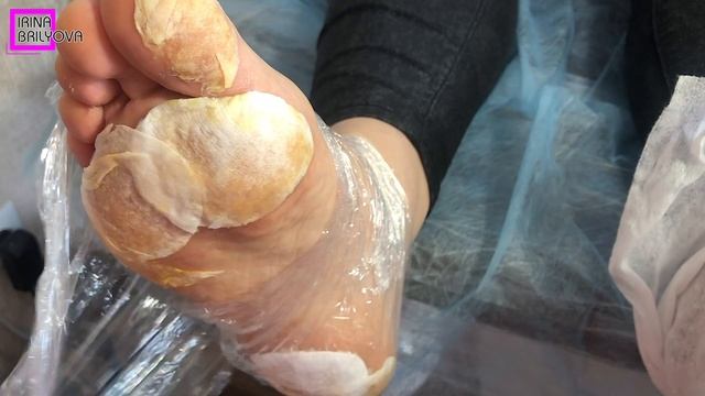 CALLUS removal 🌸 DEEP corn 🌸 Aesthetic PEDICURE 🌸 Irina Brilyova