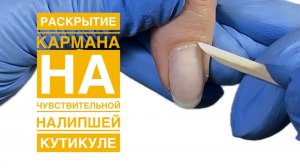 Раскрытие кармана на налипшей кутикуле