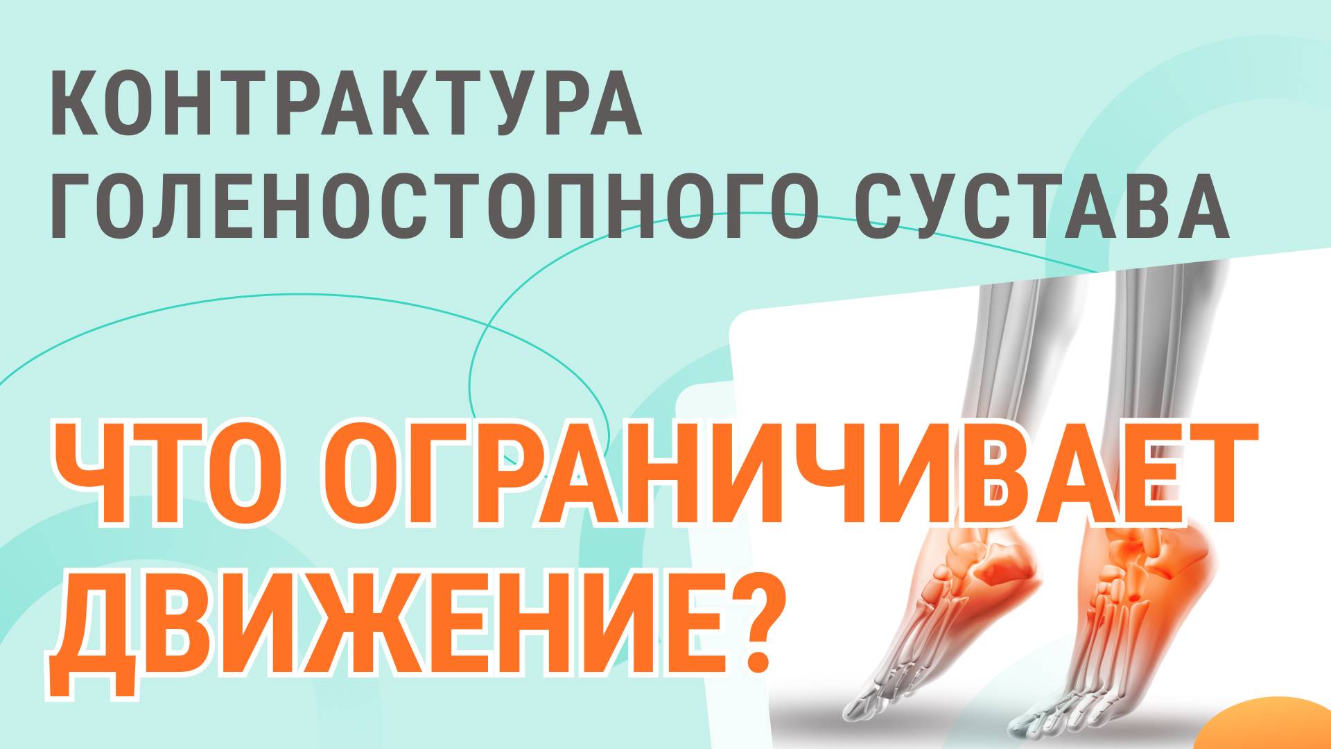 Контрактура голеностопного сустава. Что ограничивает движение?