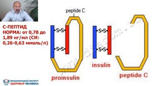 📍 КАК ПРАВИЛЬНО ОПРЕДЕЛИТЬ ТИП ДИАБЕТА - Анти Диабет Игоря Цаленчука. Диагноз Диабет - не приговор