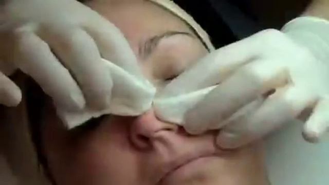 Pumpkin Peel Treatment смотреть онлайн