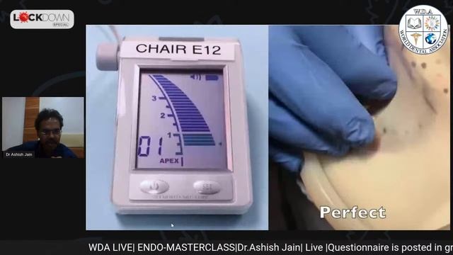 Apex Locator & Working Length ENDOMASTERCLASS смотреть онлайн