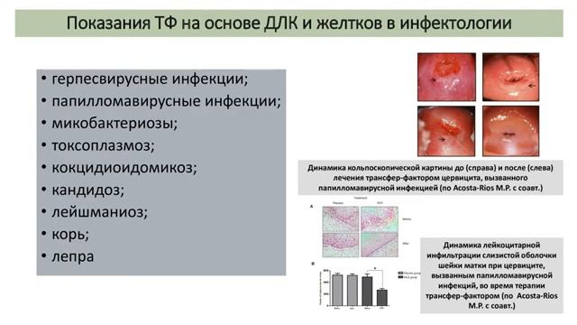 Мальцев ДВ  Показания к применению транфер фактора в клинической практике