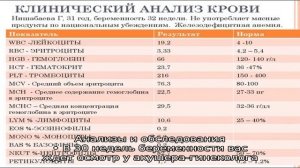 30 неделя беременности