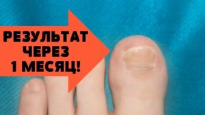 AMANDI. Жженые квасцы. Описание. Применение.