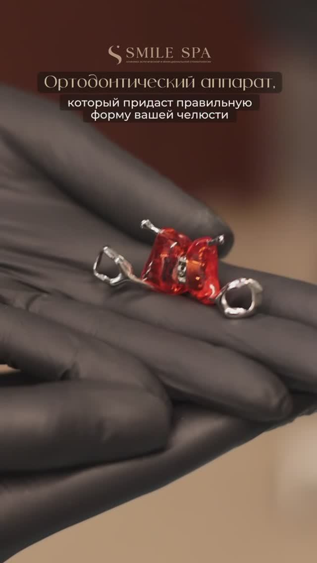Ортодонтические аппараты для придания правильной формы челюсти. Стоматология Smile Spa Одинцово
