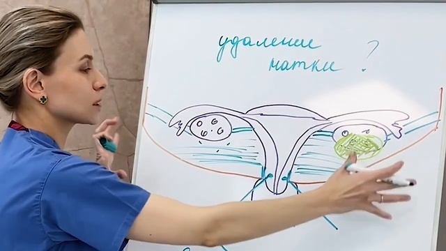 Когда и кому надо удалять матку?