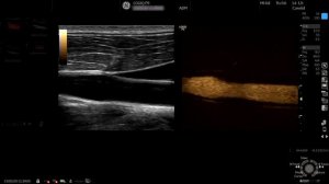 Обзор УЗИ аппарата General Electric Logiq P9