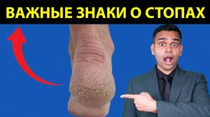 ВНИМАНИЕ - ВАША СТОПА МОЖЕТ МНОГОЕ СКАЗАТЬ О ВАШЕМ ЗДОРОВЬЕ!