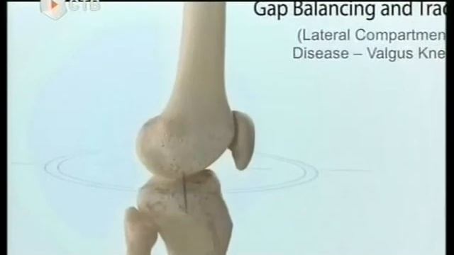 Мед карта 3 рус смотреть онлайн