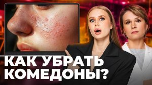 Как избавиться от рубцов и комедонов? Разбираем по фактам видео бьюти-блогеров