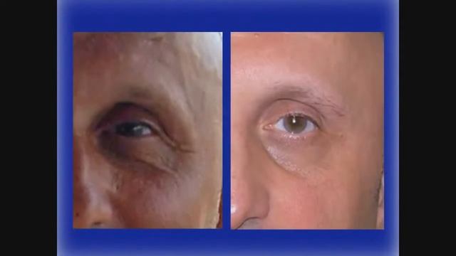 11. Результаты применения продукции Jeunesse Global смотреть онлайн