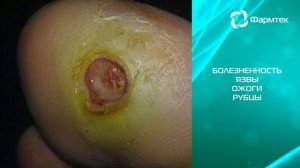 Видеореклама для лекарственного препарата Vartoks