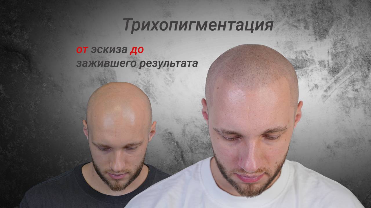 А тебе, лысый, я телефон дам (часть 2)