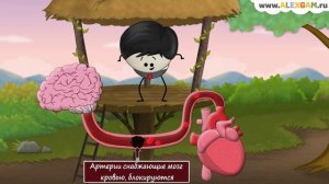 Что такое инсульт?