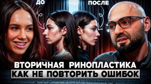 Вторичная ринопластика: как выбрать хирурга и не повторить ошибок