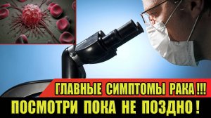 Главные симптомы РАКА! Врачи назвали три пугающих сигнала! Посмотри ПОКА НЕ ПОЗДНО! #здоровье #рак