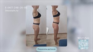 Кабинет похудения и коррекции фигуры в 1 аппарате, кавитация, массаж, лифтинг лица и тела