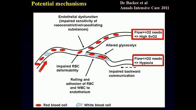 What is hypoperfusion Daniel De Backer 2014