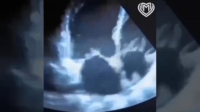 💔У москвички в прямом смысле разбилось сердце, после потери питомца💔