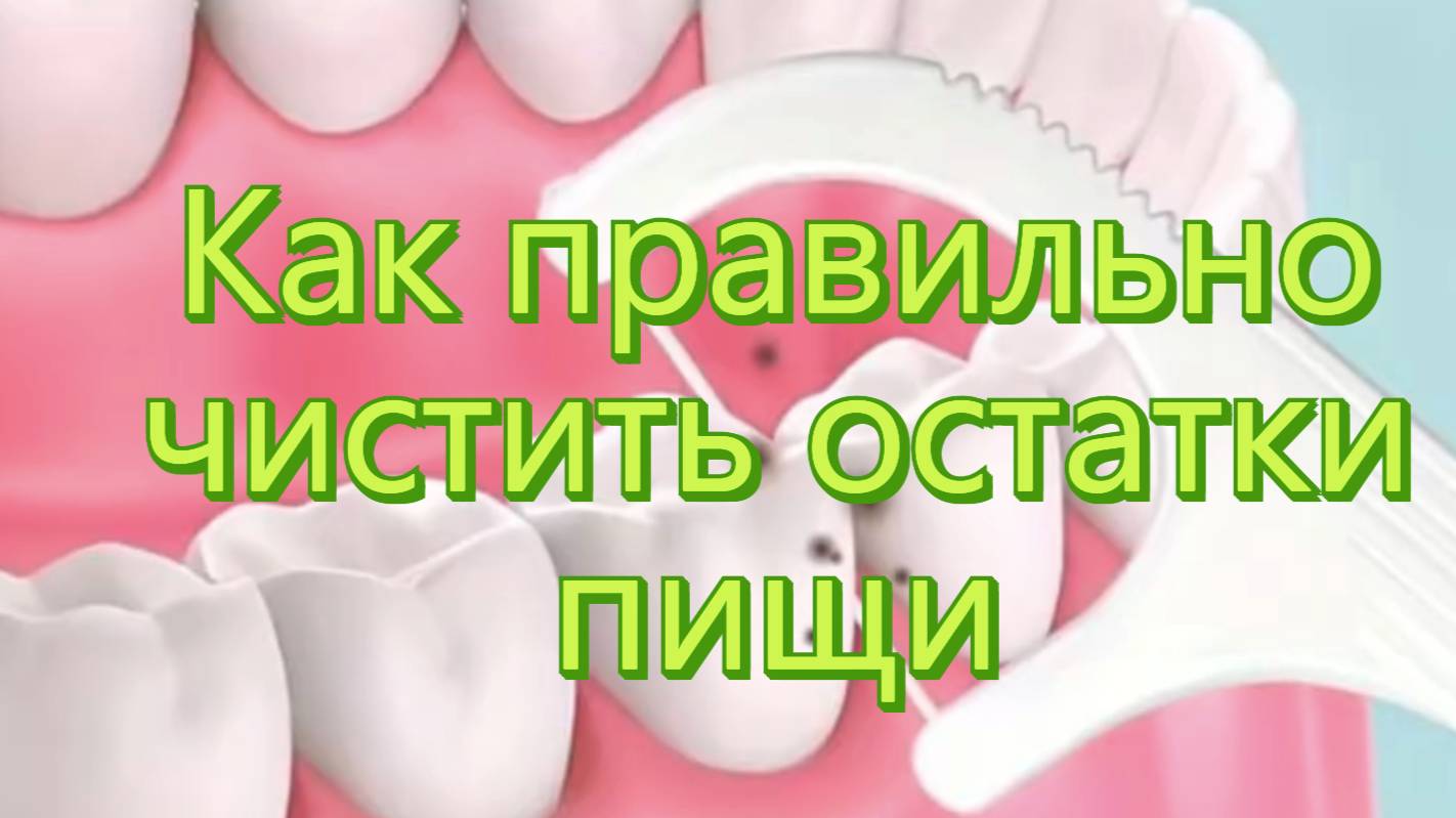 📢 Как правильно удалять остатки пищи между зубами?