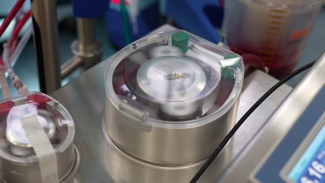 Комплексное хирургическое лечение тяжёлого сочетанного заболевания сердца и аорты. Отзыв пациента