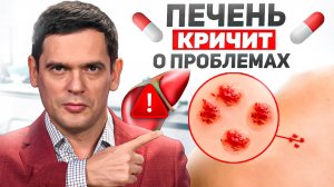 5 Самых РАННИХ Симптомов Проблем с Печенью! НЕ ИГНОРИРУЙ ИХ!!!