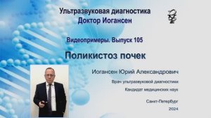 Ультразвуковая диагностика. Доктор Иогансен. Видеопримеры. Выпуск 105. Поликистоз почек.