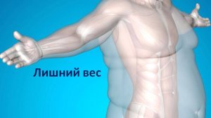 Лишний вес и ожирение