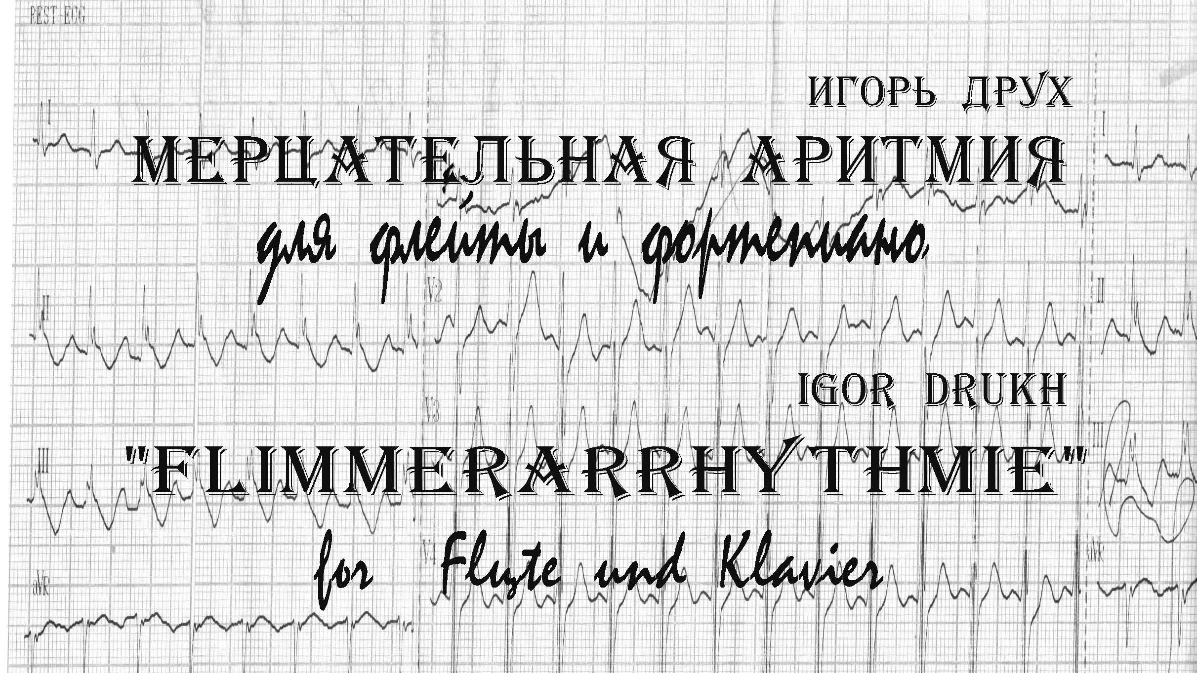 Мерцательная аритмия для флейты и фортепиано (памяти отца)