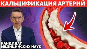 КАЛЬЦИЙ В АРТЕРИЯХ - ЭТО ГРОЗИТ КАЖДОМУ, ЕСЛИ НЕ ЗНАТЬ ЭТОГО!