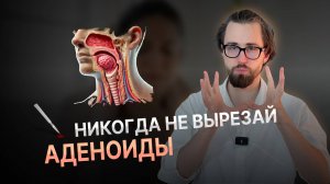 АДЕНОИДЫ: причины, симптомы и лечение без операции