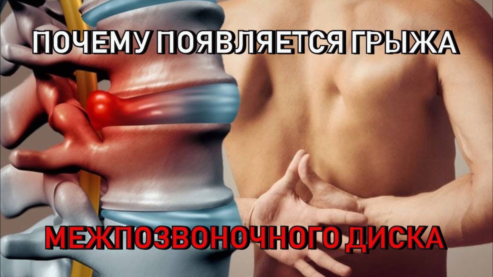 Почему появляется грыжа межпозвоночного диска. Как помочь.